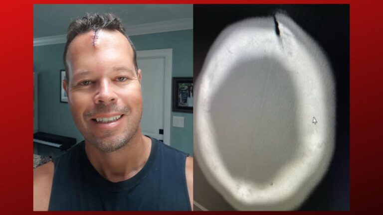 Local firefighter attacked by ax to the head while responding to a call