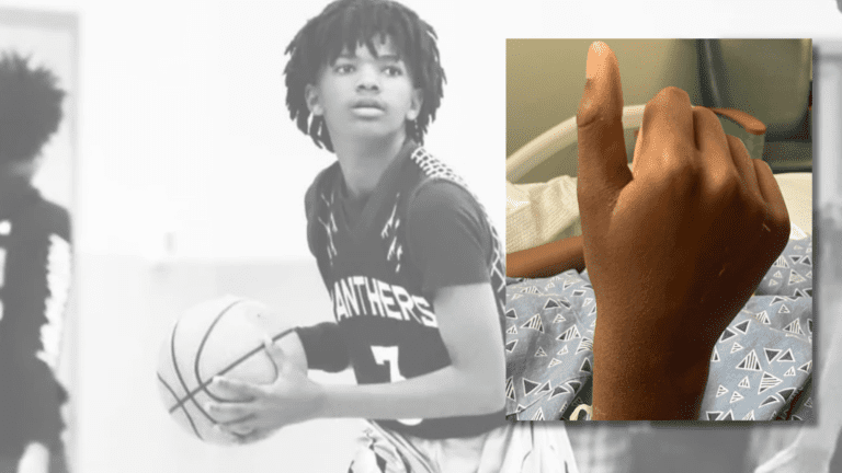 Major update on Kamari who continues to fight after being shot in the head